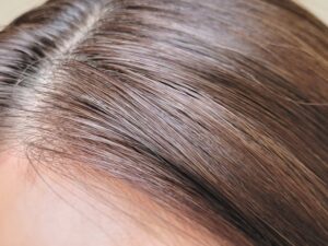 SMP（ヘアドットメイク）で自然な増毛効果！薄毛の悩みを解決する選択肢