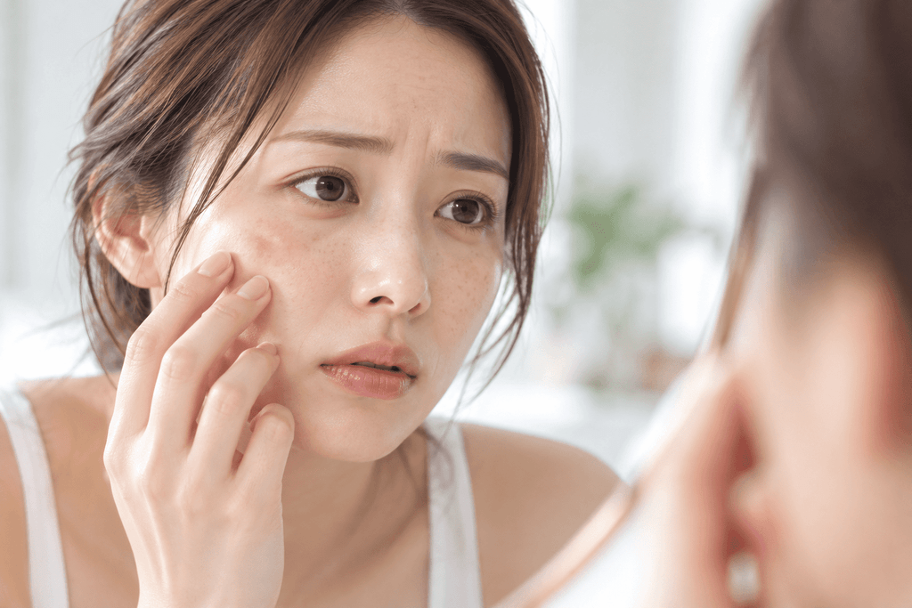 【名古屋・栄】ルメッカとレーザーフェイシャルの違いは？薄いシミ・そばかす・くすみを一掃する選び方